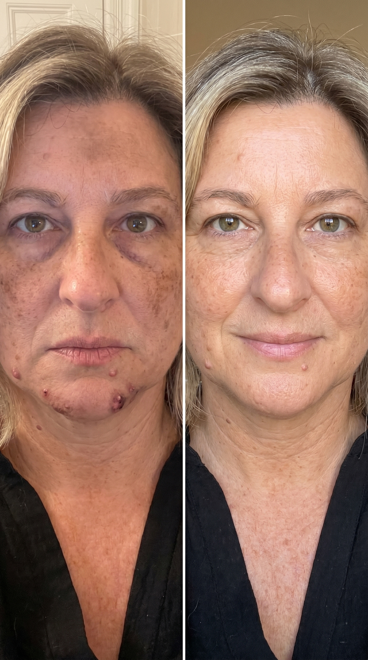 Real Quiet Retinol result