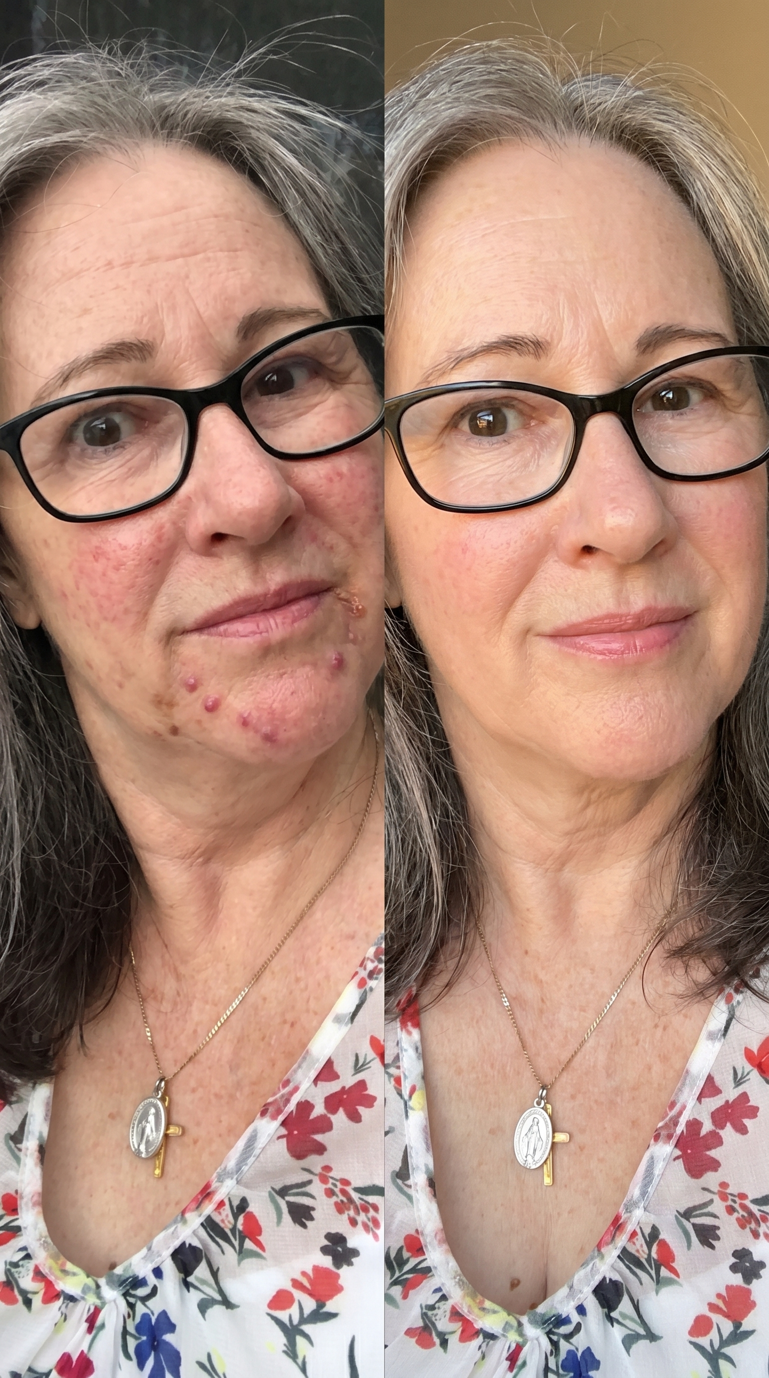 Real Quiet Retinol result