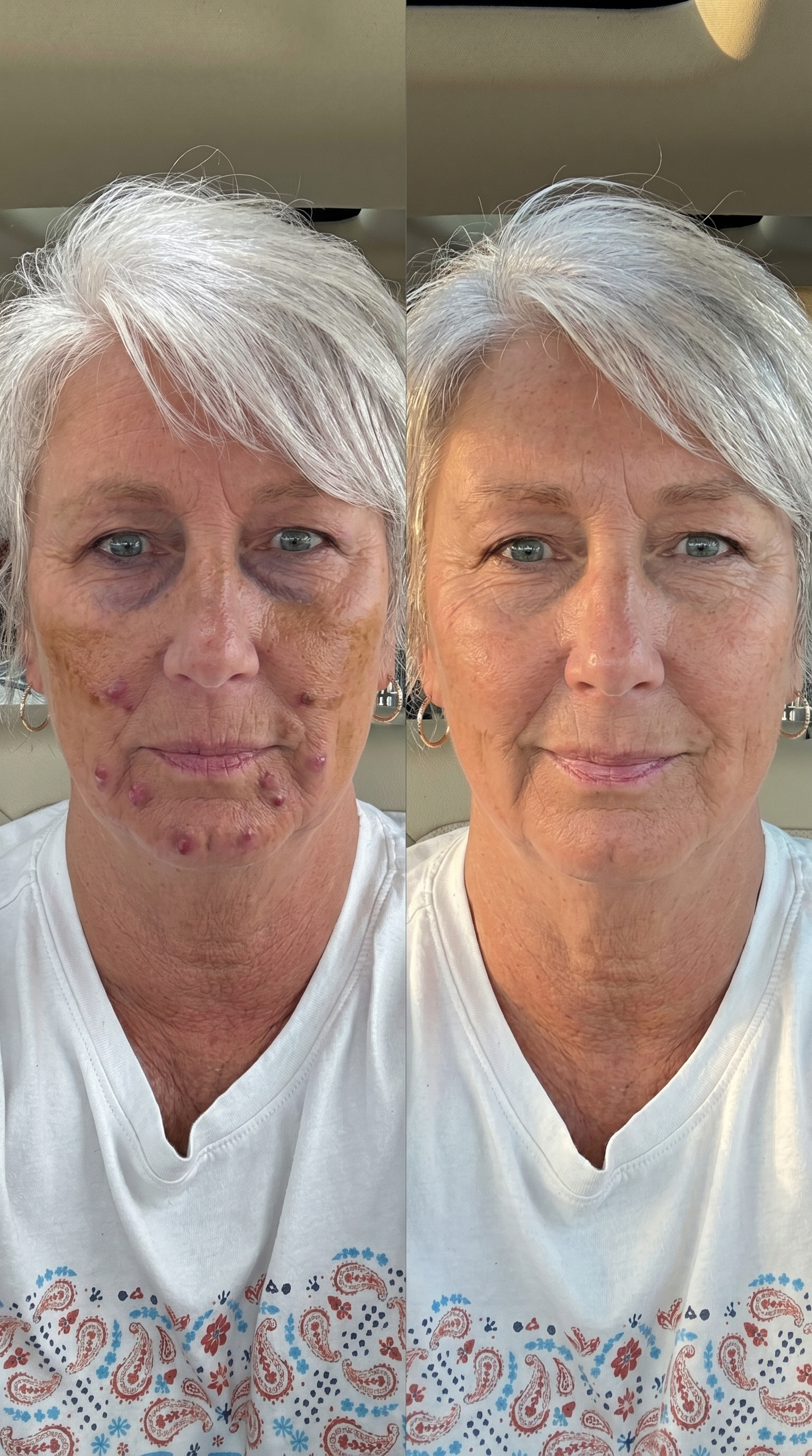 Review from Helen, 63